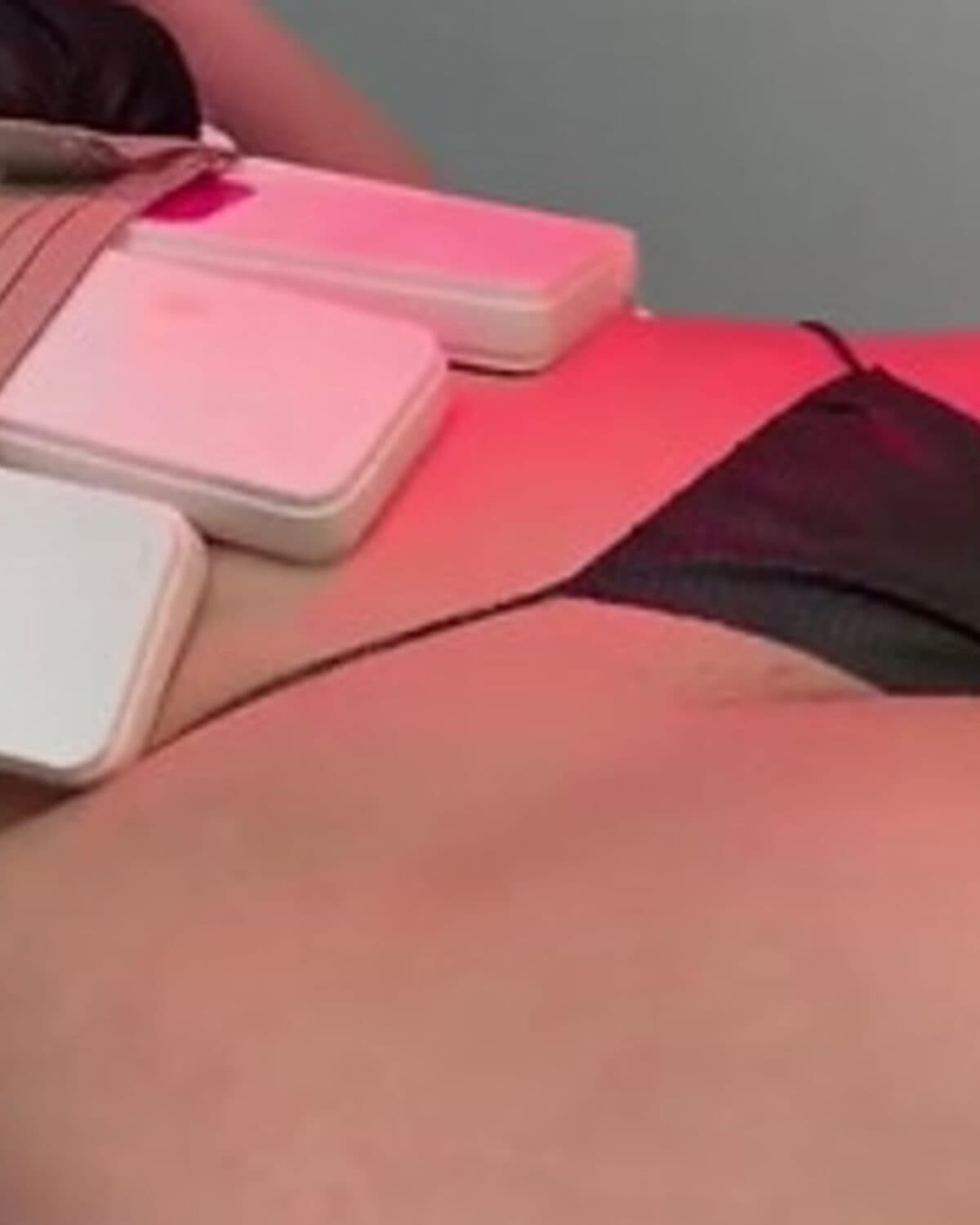 Body contouring at Orange Sculpting